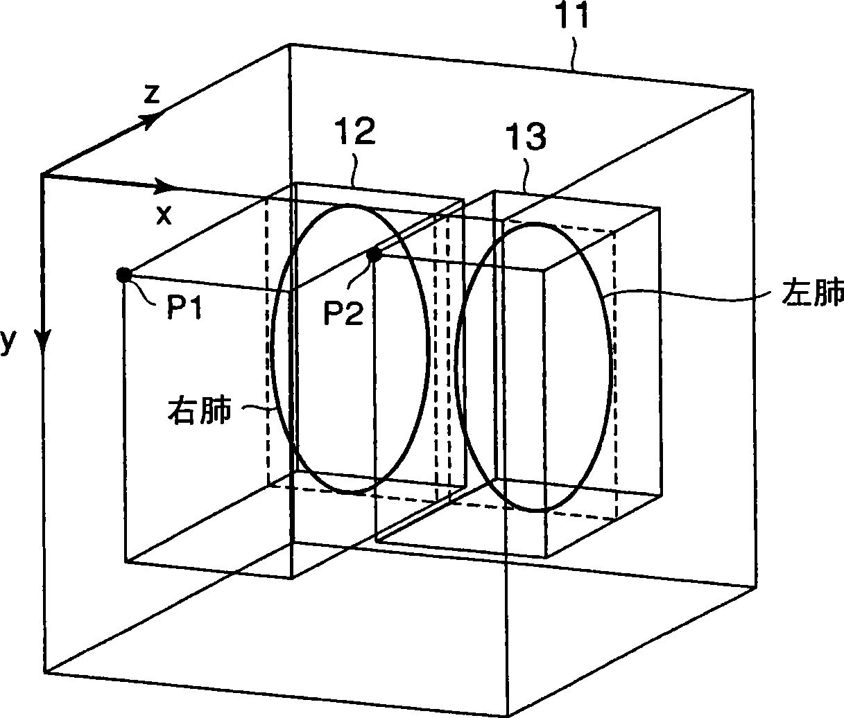 Image diagnosis support system, medical image management apparatus, image diagnosis support processing apparatus and image diagnosis support method