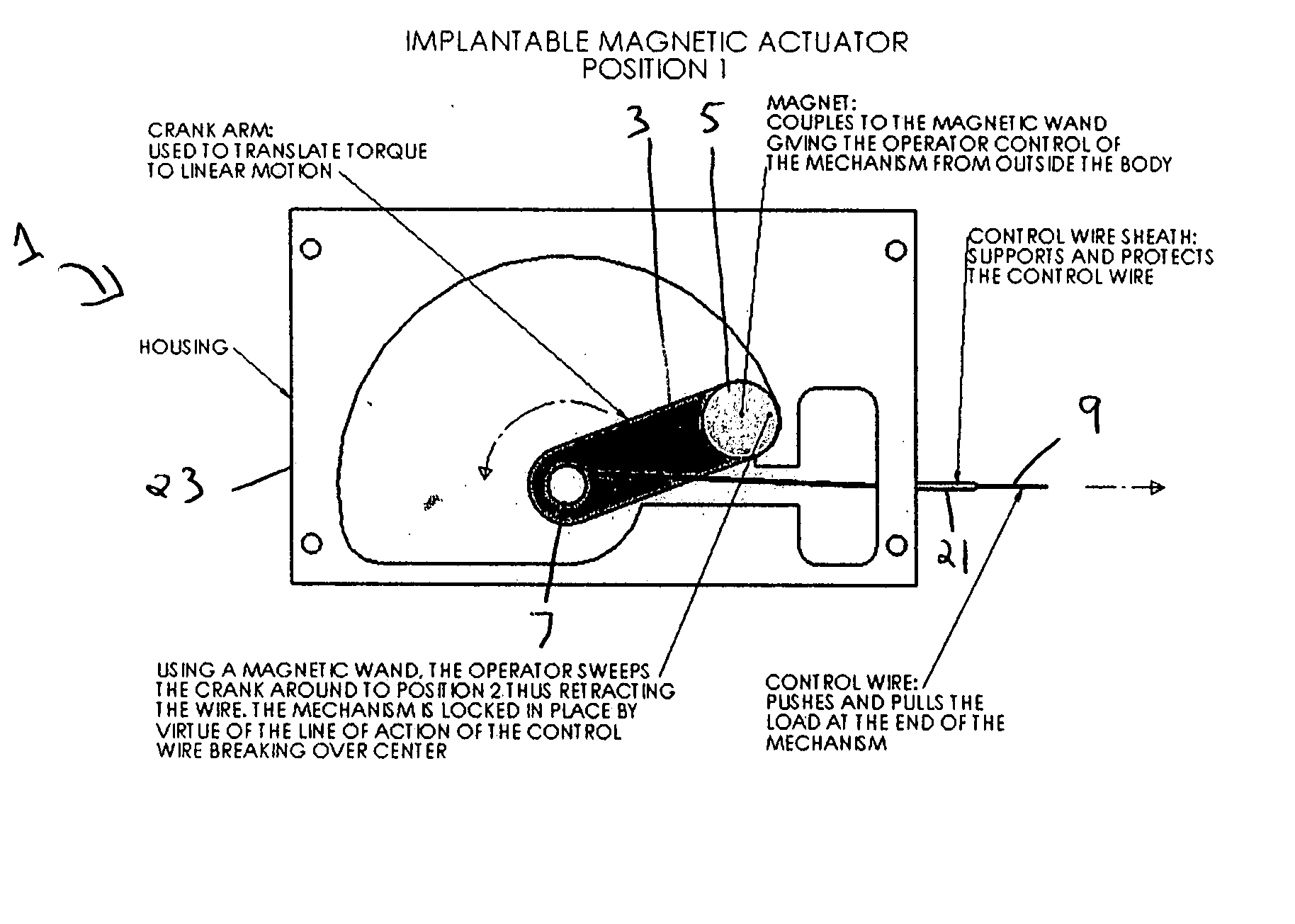 Implantable, magnetic actuator