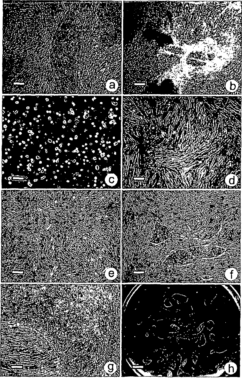 Culture system and method for propagation of human blastocyst-derived stem cells