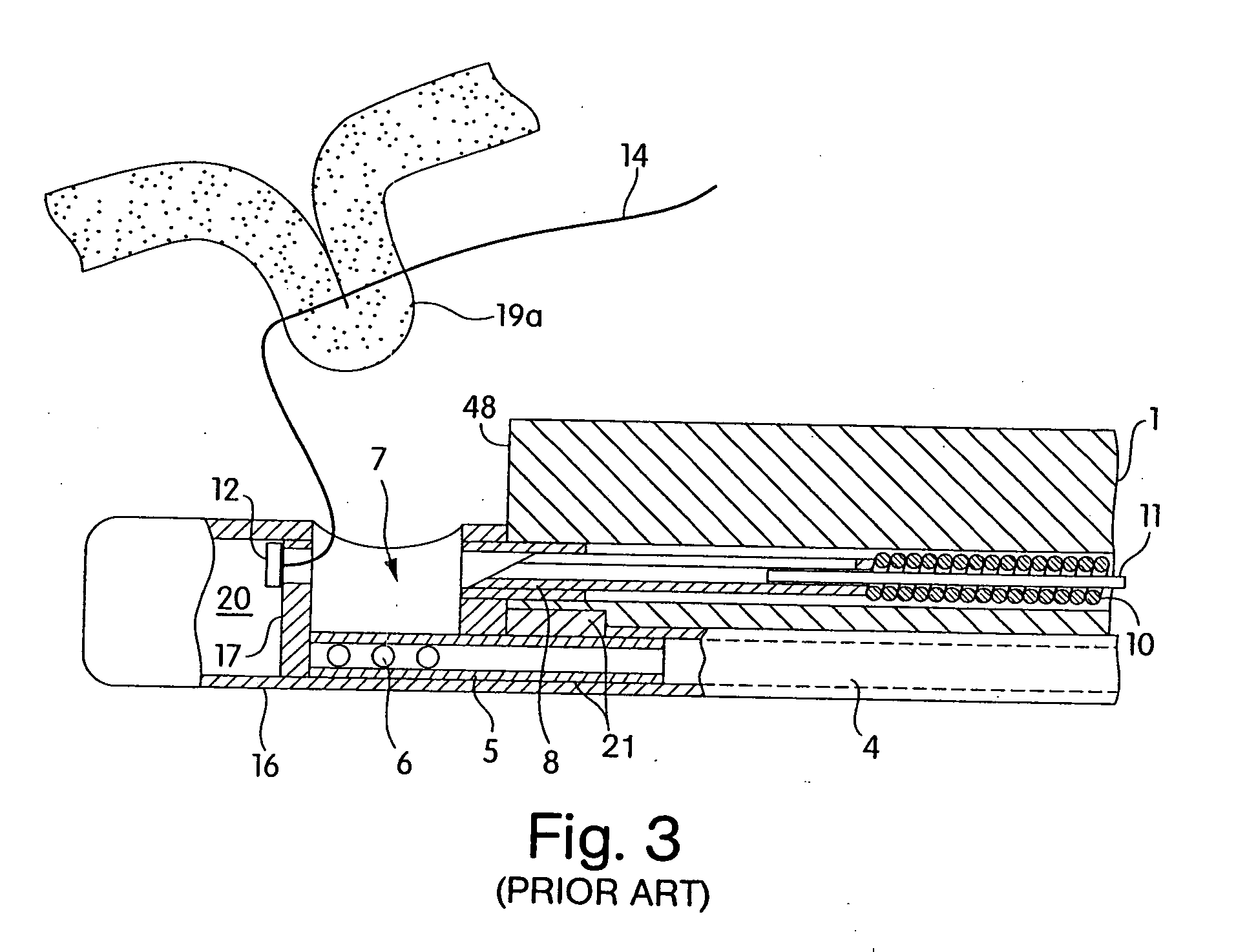 Integrated endoscope and accessory treament device