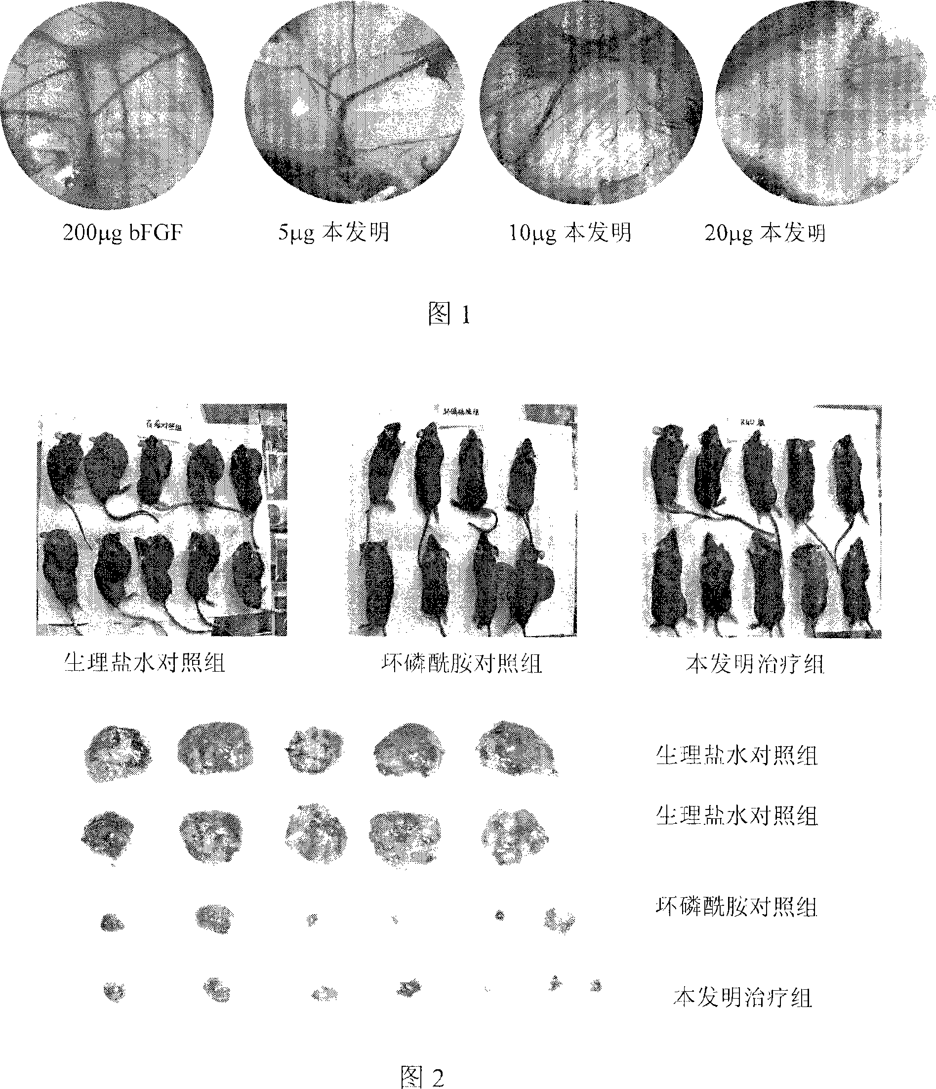 Agkistrodon halys ussuriensis disintegrin site-directed mutants cDNA clone, expression and protein preparation method and application thereof