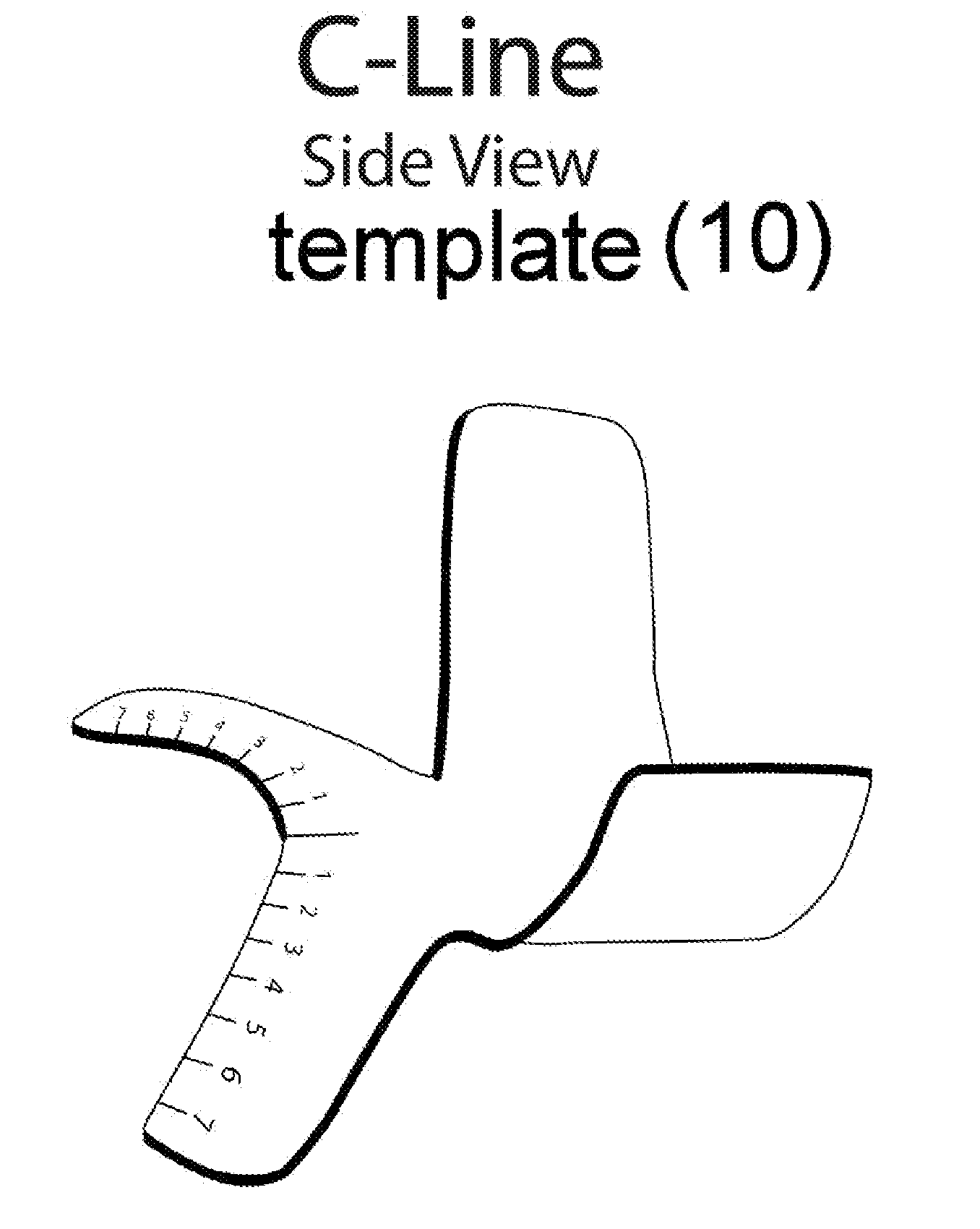 Cesarean Delivery Incision Template