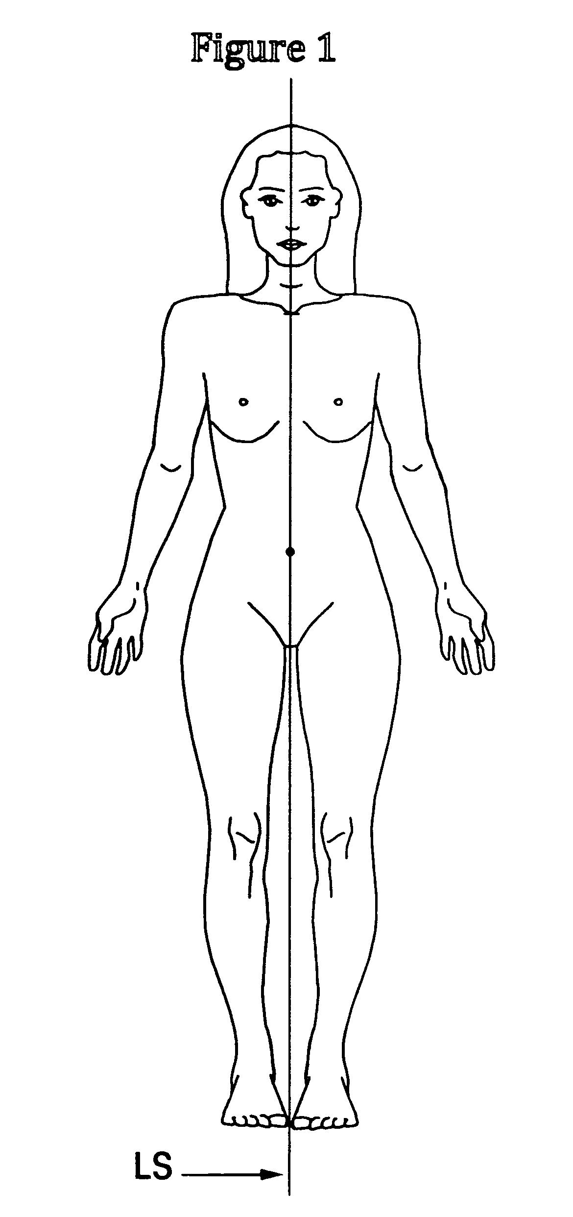 Cesarean Delivery Incision Template