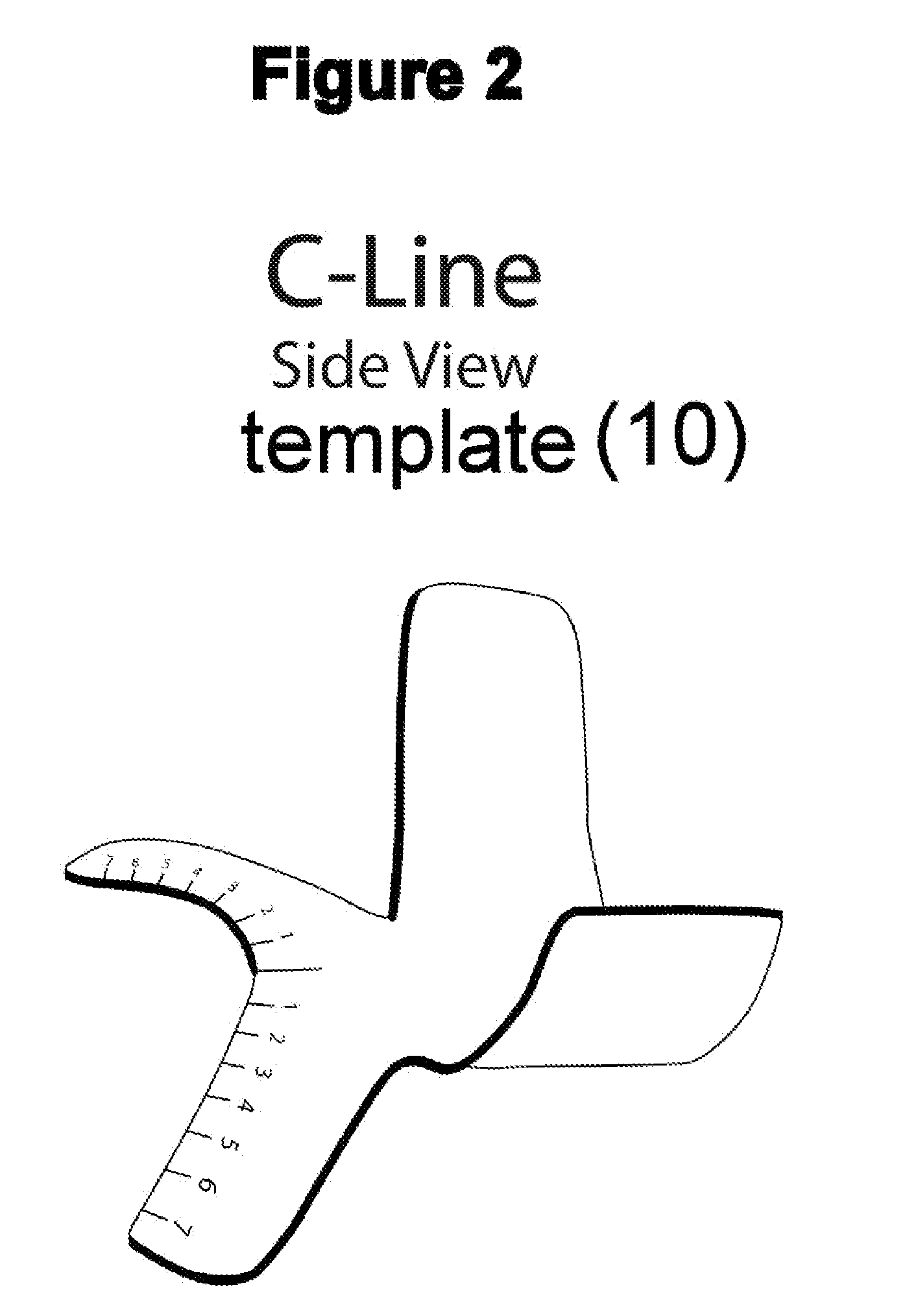 Cesarean Delivery Incision Template