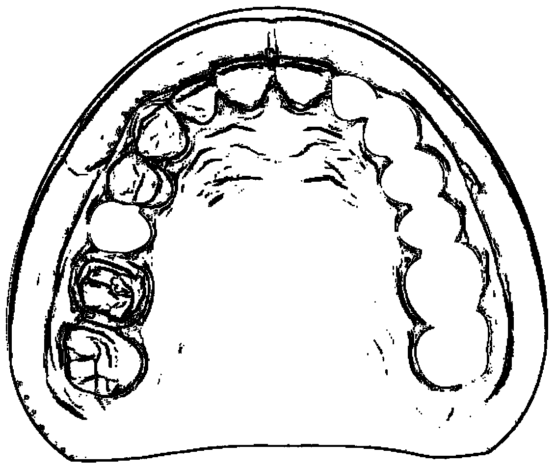 Method for manufacturing oral prostheses stent formed by composite processing of additional and subtractive material