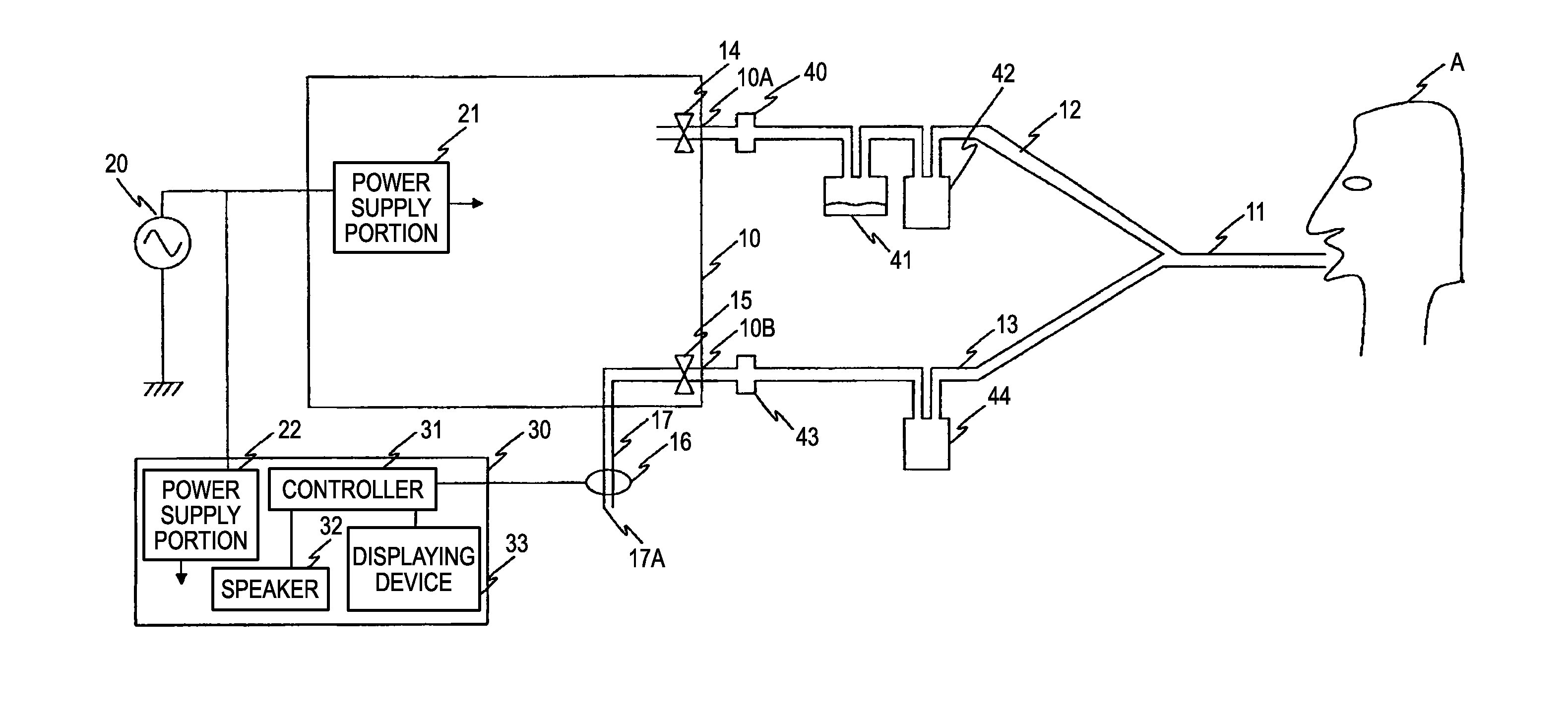 Artificial ventilation apparatus