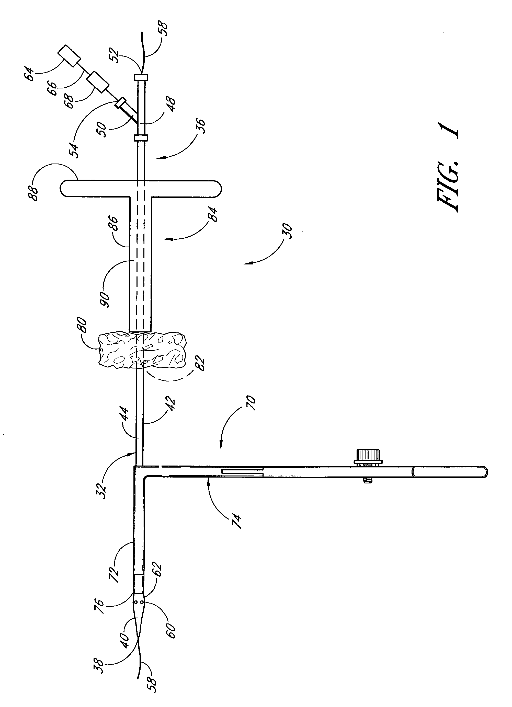 Vascular wound closure device and method