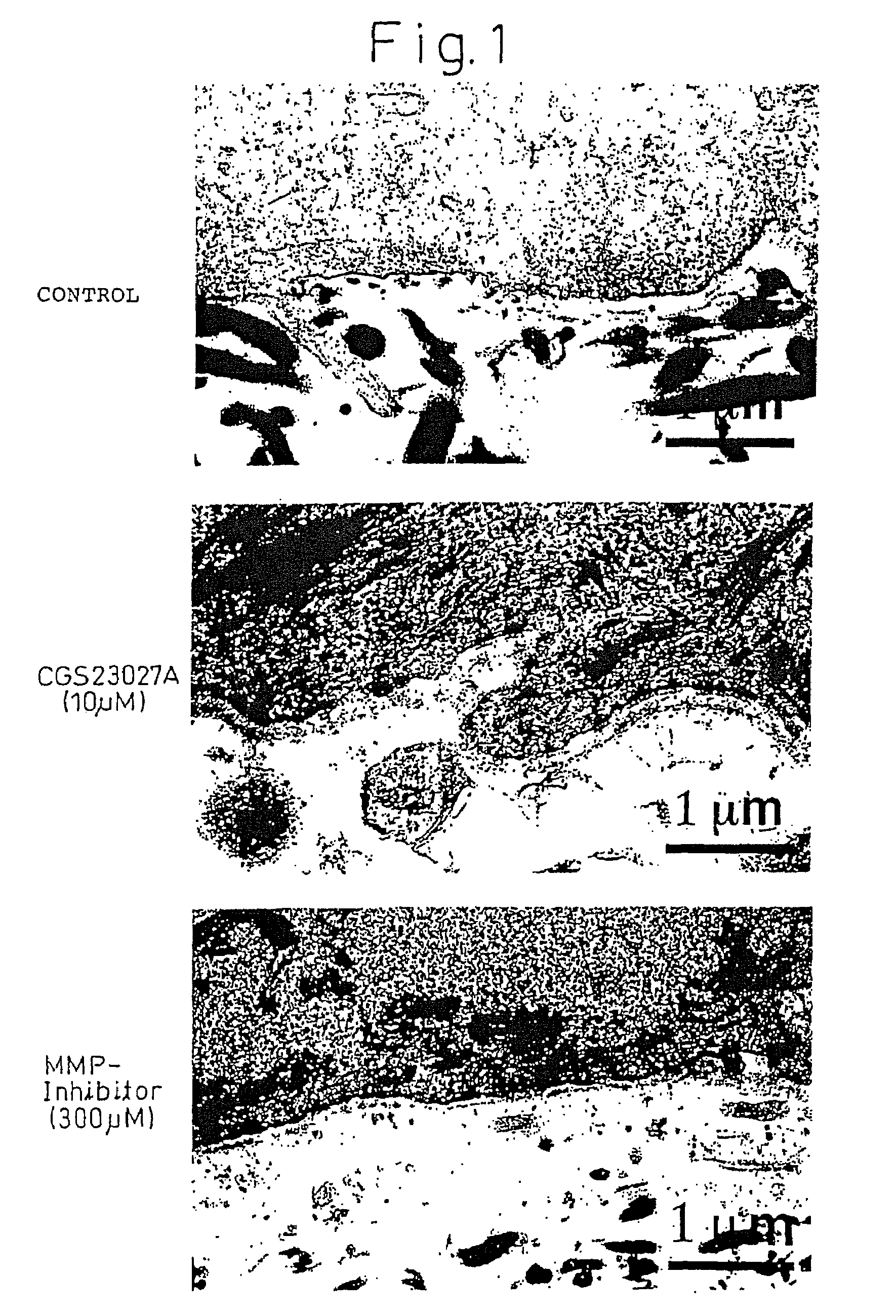 Method of production of artificial skin