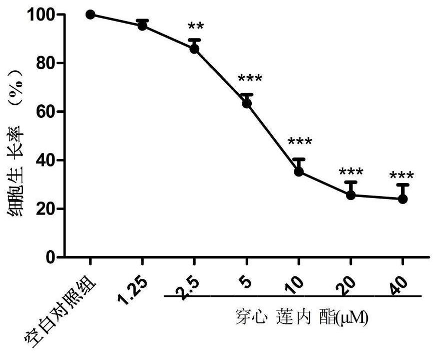 Application of combination of andrographolide and dexamethasone to preparation of compound medicines for resisting acute lymphoblastic leukemia