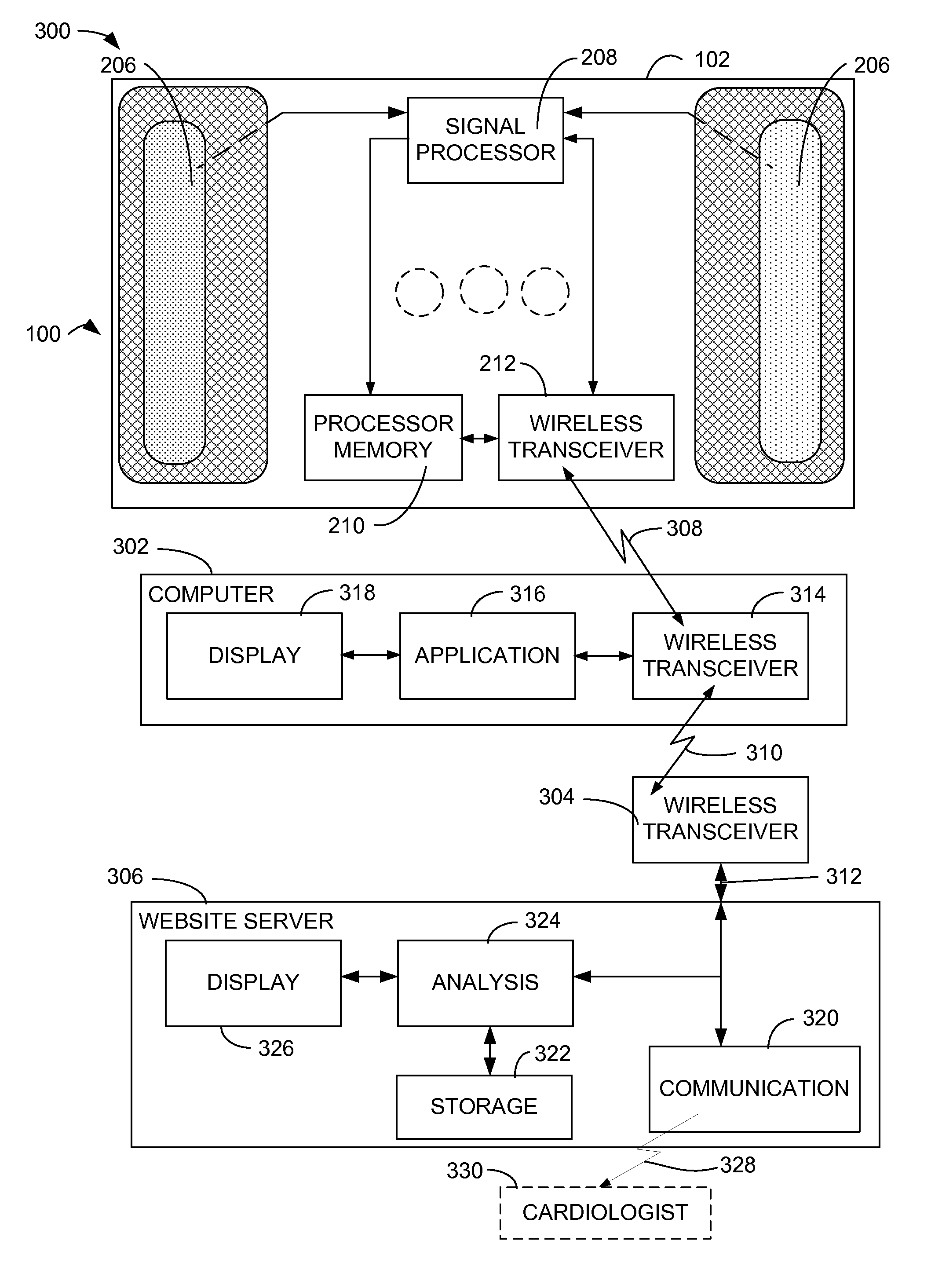 Small wireless portable ekg system