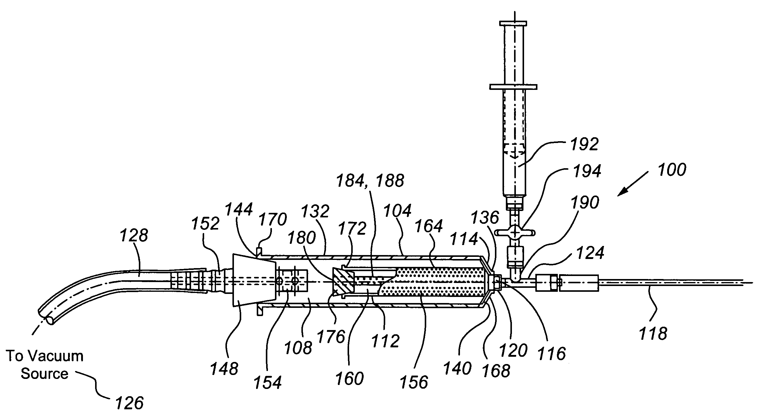 Tissue transplantation method and apparatus