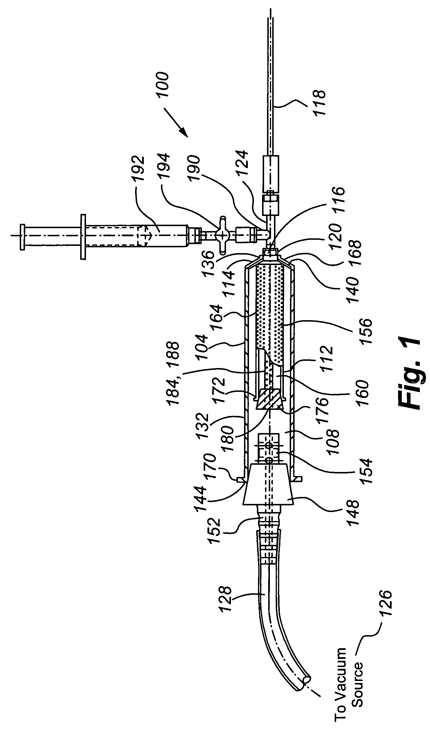 Tissue transplantation method and apparatus