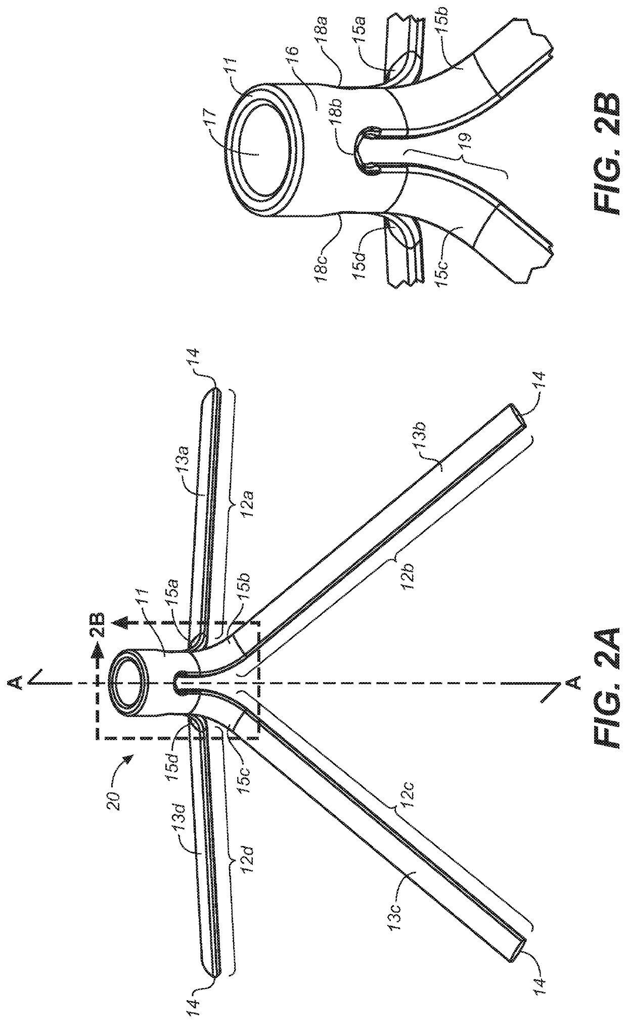 Implantable devices and methods to treat benign prostate hyperplasia (BPH) and associated lower urinary tract symptoms (LUTS)