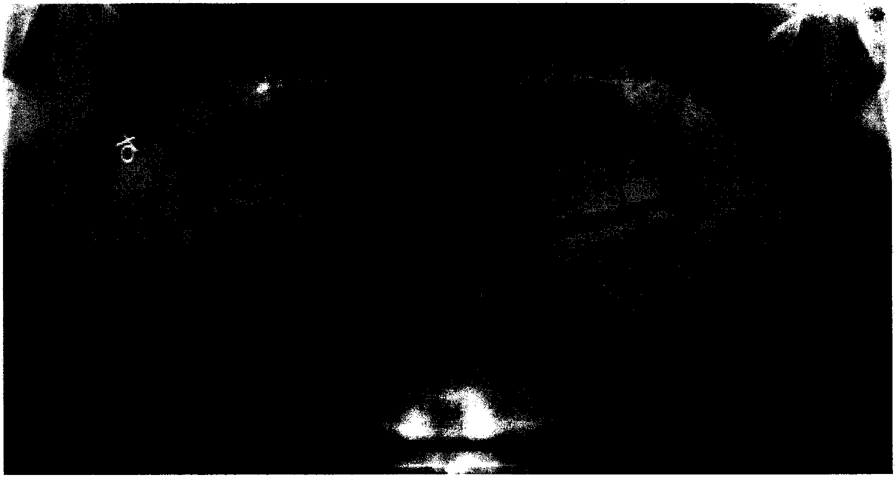 Frequency domain filtering-based CBCT (Cone Beam Computed Tomography) panoramic image enhancement method