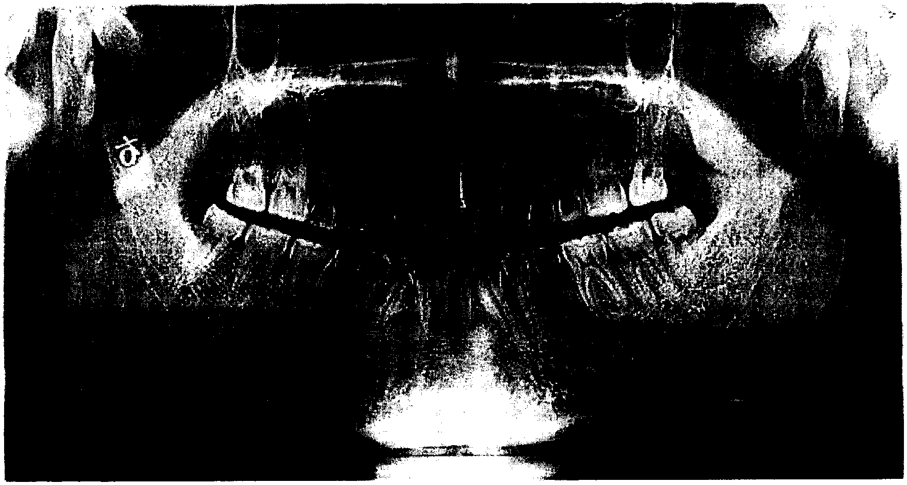 Frequency domain filtering-based CBCT (Cone Beam Computed Tomography) panoramic image enhancement method