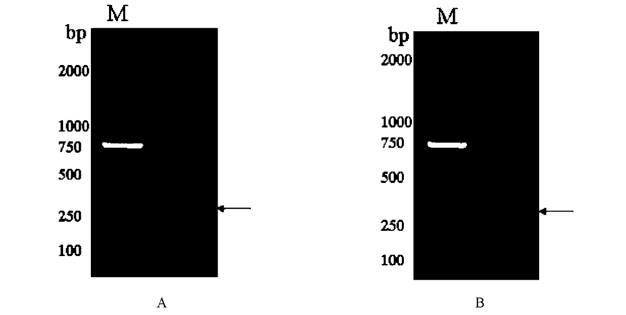 Tick cystatin Rhcyst-1, and gene and applications thereof