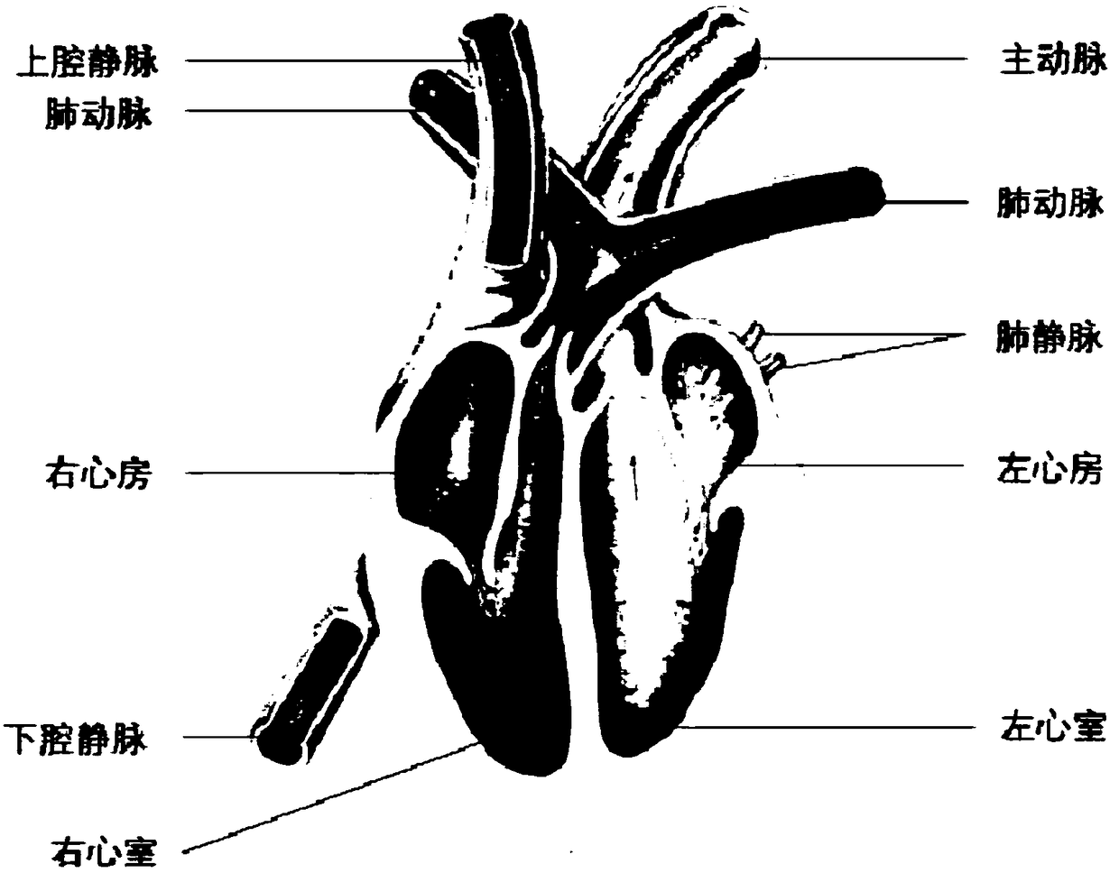 Device and method for preoperative evaluation of congenital heart disease operation plan by means of 3D printing