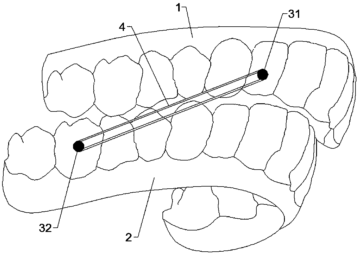 Composite device for simultaneously realizing three-dimensional movement of orthodontic teeth by extending mandible forwards