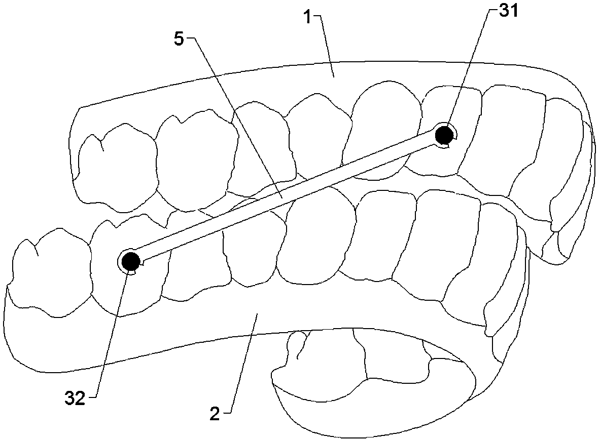 Composite device for simultaneously realizing three-dimensional movement of orthodontic teeth by extending mandible forwards