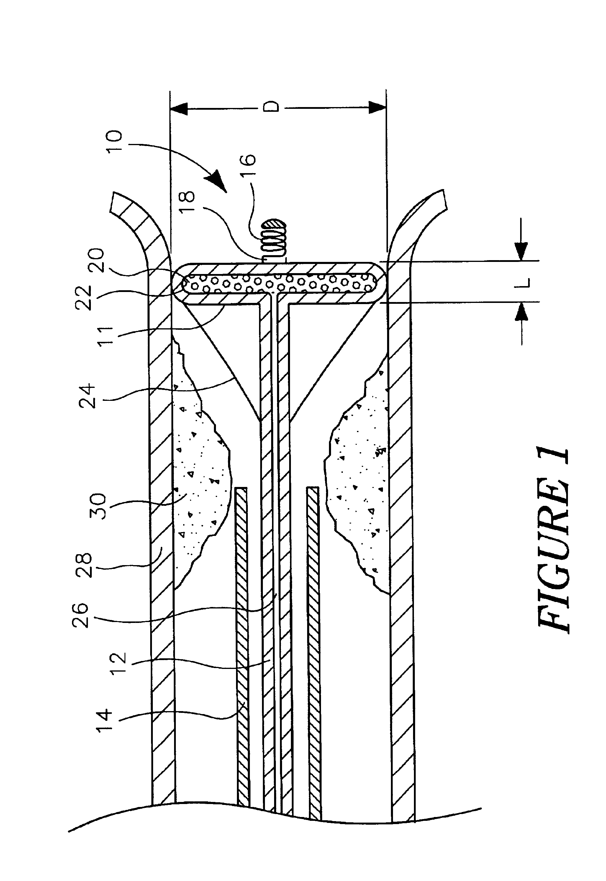 Disc shaped filter