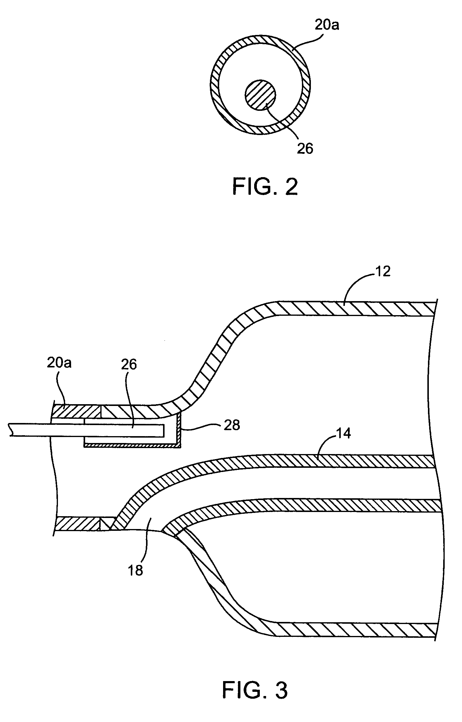 Balloon catheter with kink resistant distal segment