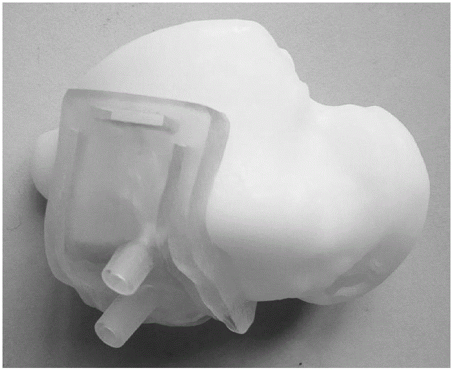 3D-printing-based restoration rebuilding method of large-range osteochondral lesions of talus