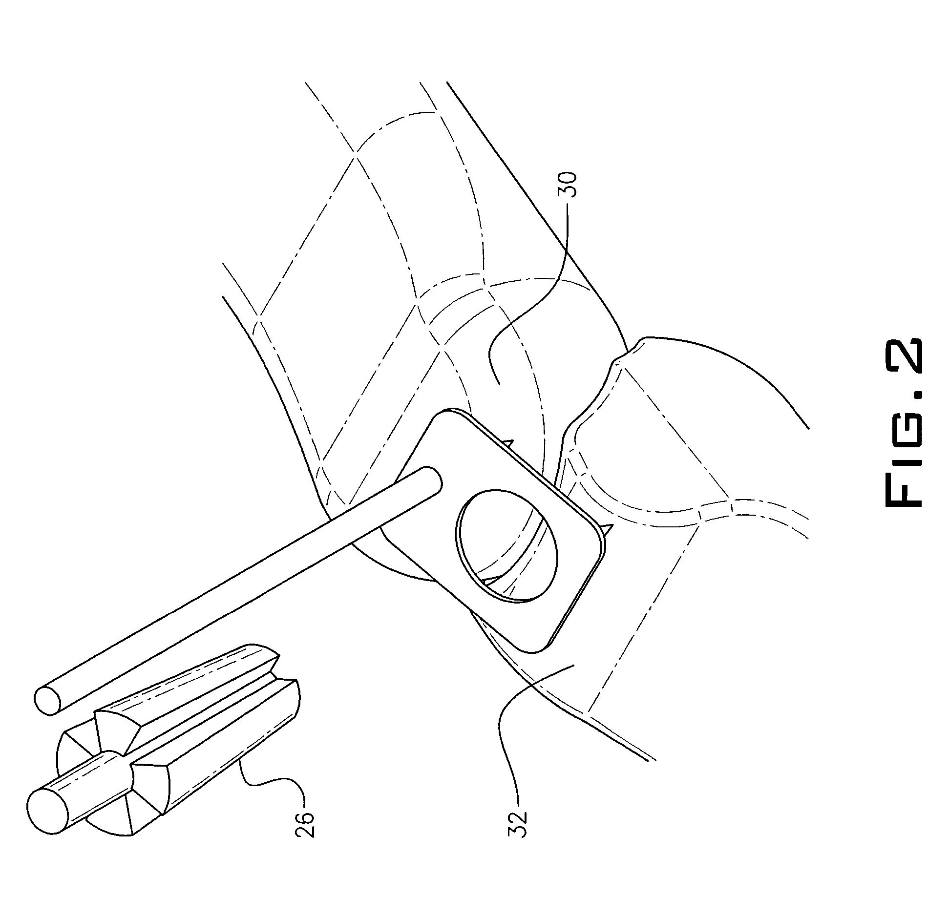 Spinal plug for a minimally invasive facet joint fusion system