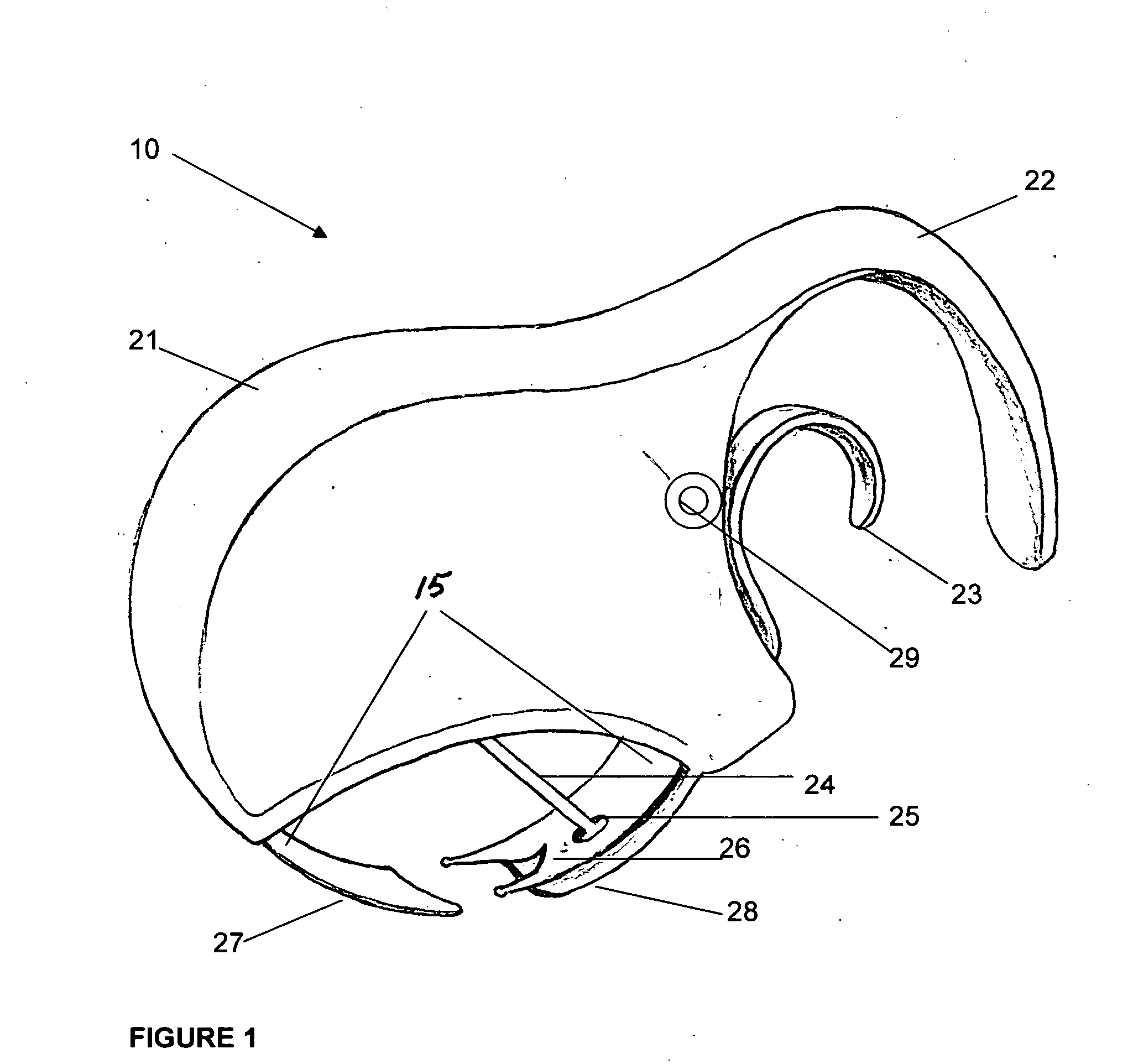 Band blade suture remover apparatus and method