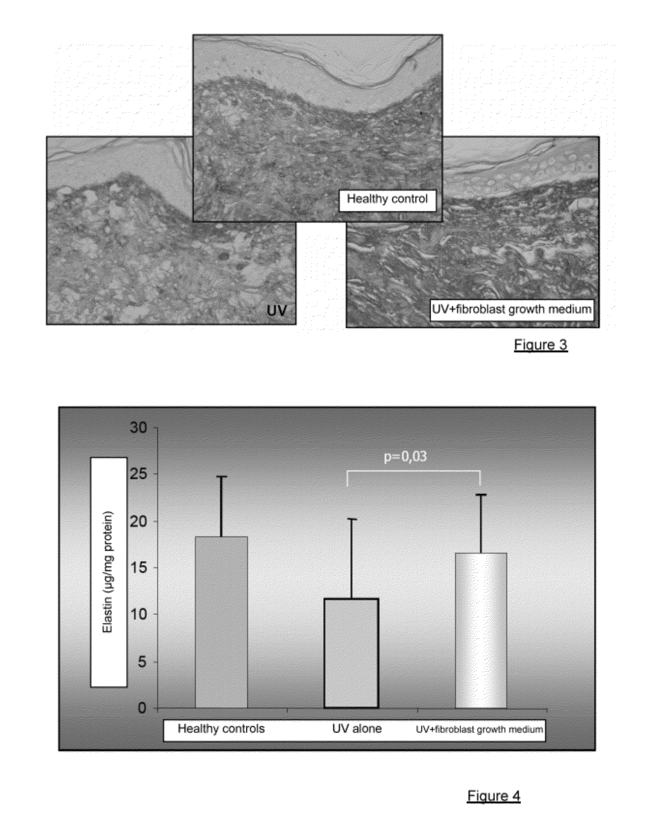 Injectable composition combining a filling agent and a fibroblast growth medium