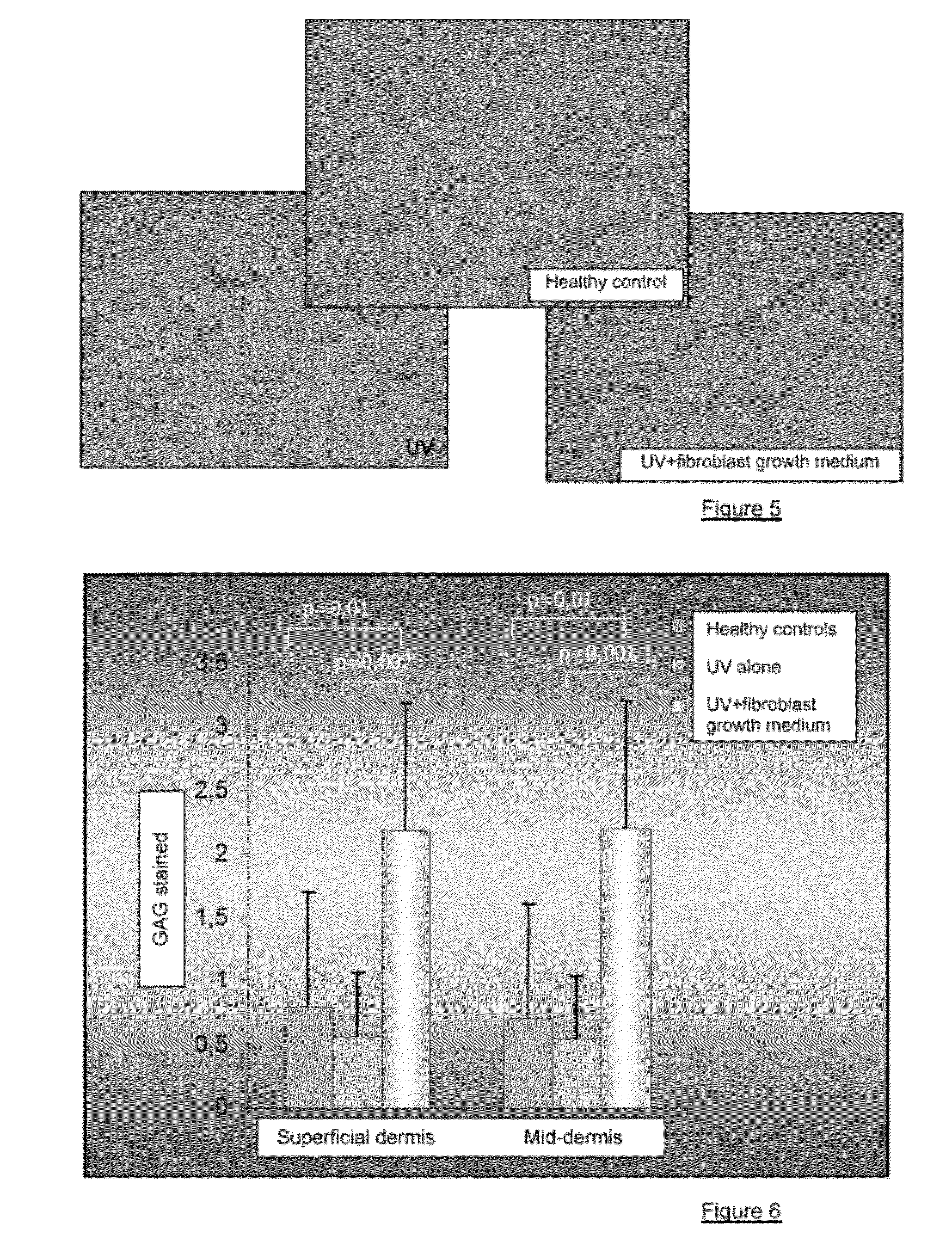 Injectable composition combining a filling agent and a fibroblast growth medium