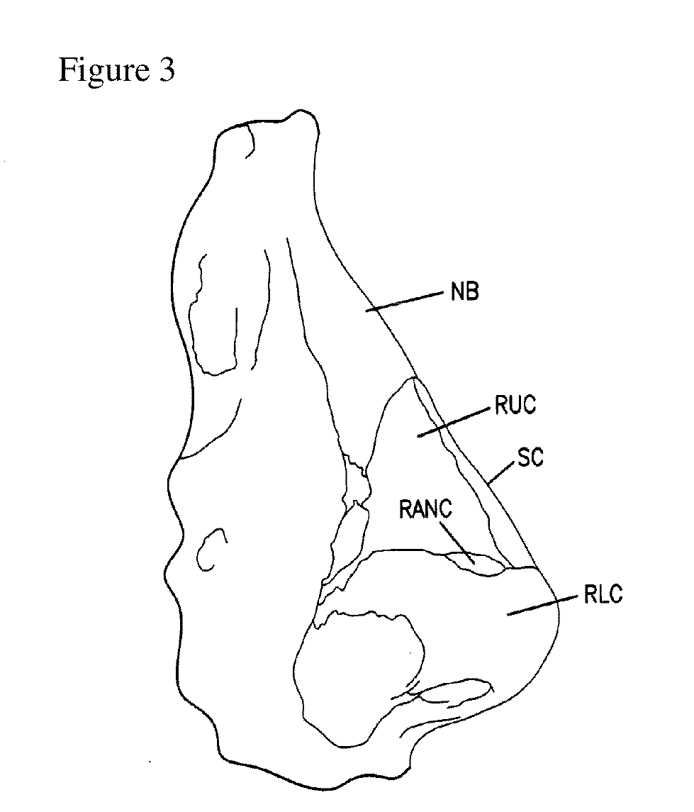 Nasal implant introduced through a non-surgical injection technique