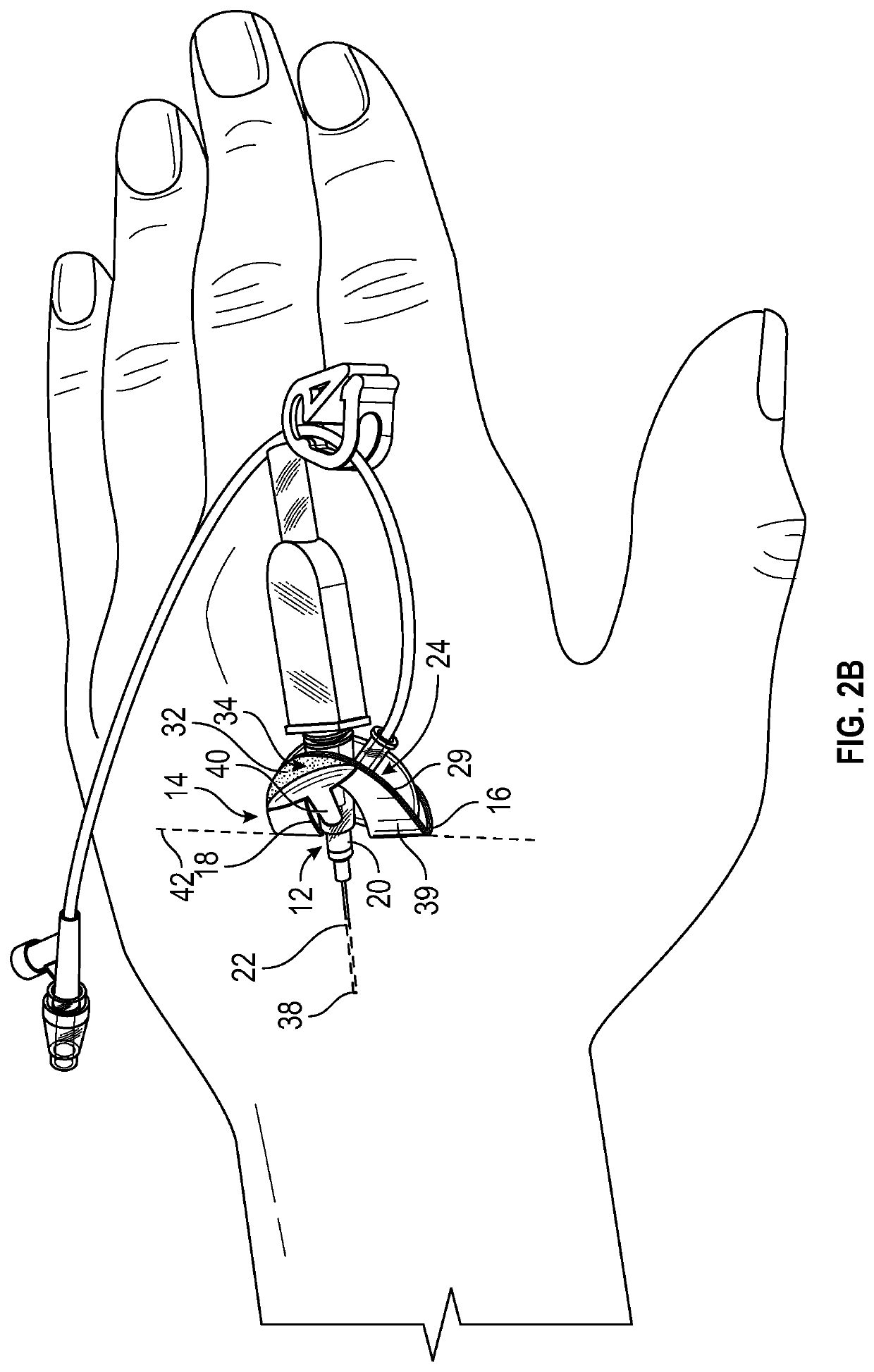 Integrated vascular access device and anchor pad