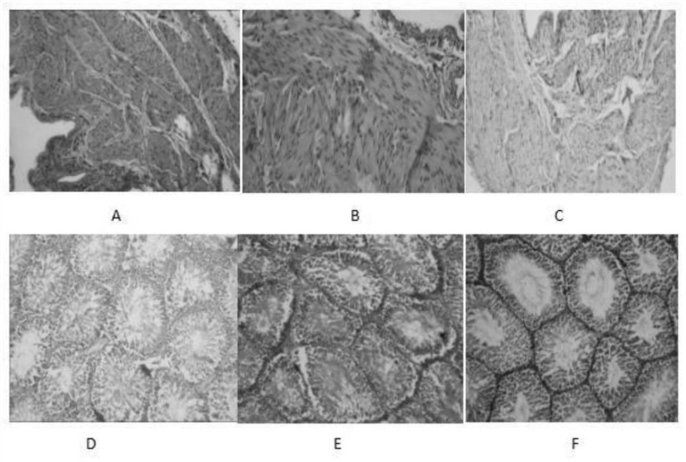 A veterinary Fengli granule and its application in chicken necrotizing enteritis