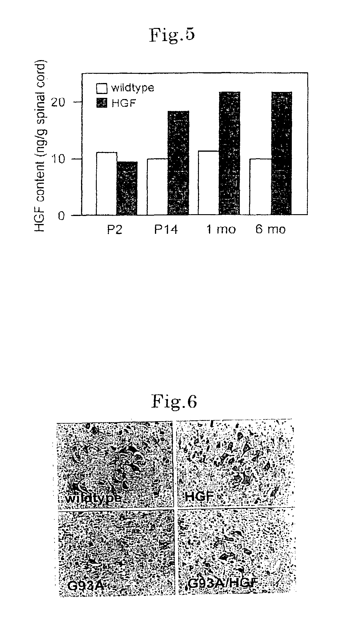 Methods of treating amyotrophic lateral sclerosis by HGF