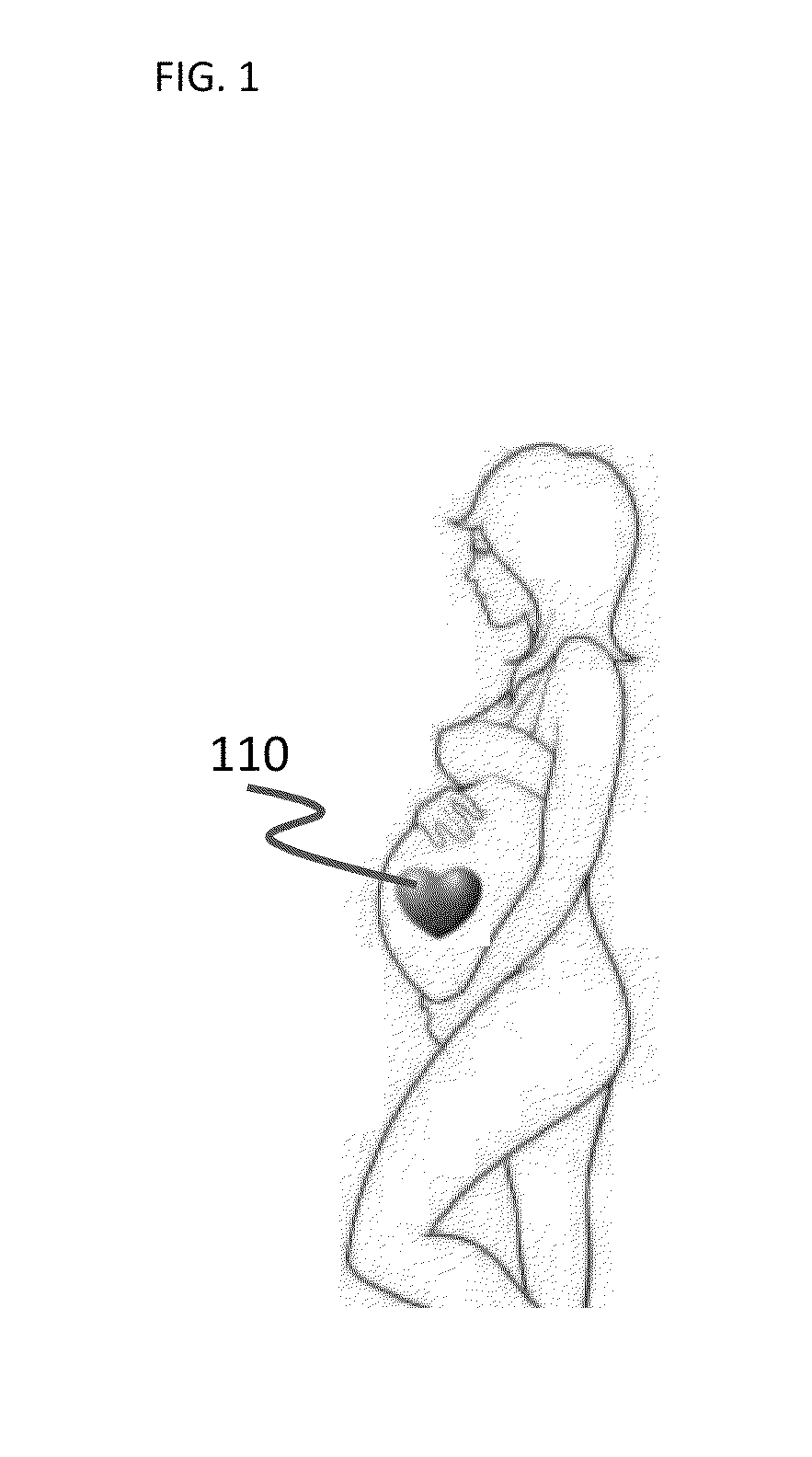 Fetal monitoring tattoo