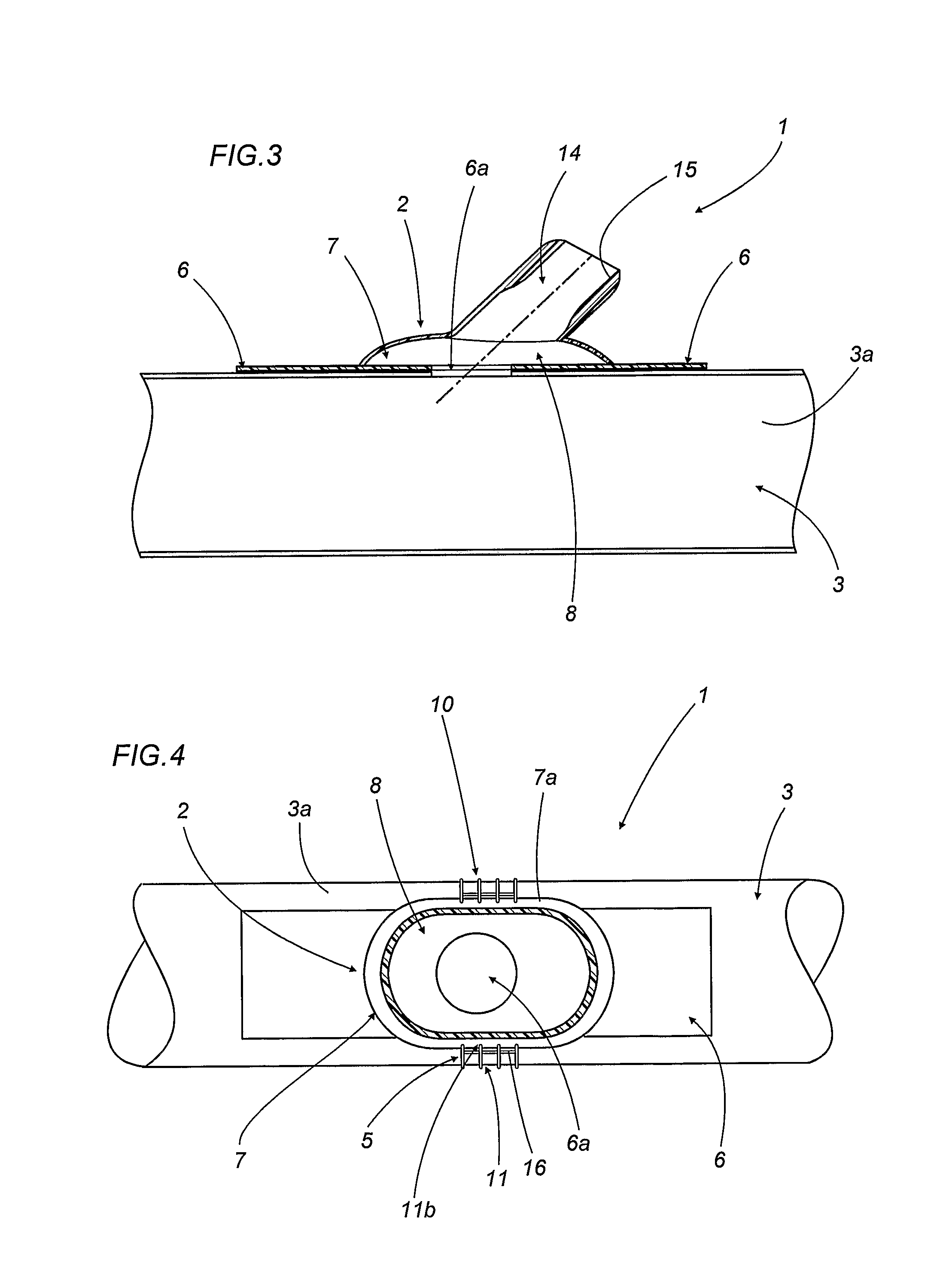 Device For End-To-Side Anastomosis