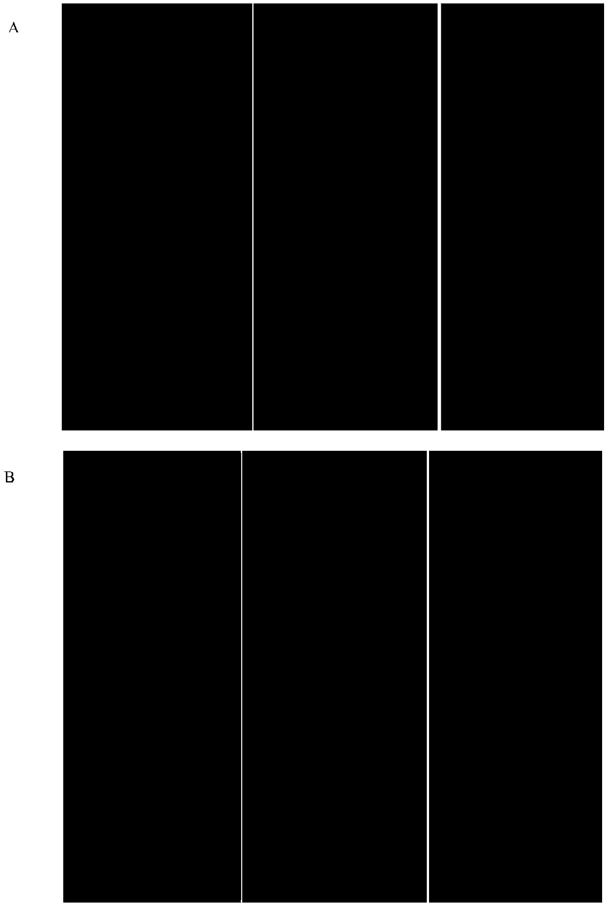 Application of 3-hydroxybutyric acid and derivatives thereof in preparation of anti-atherosclerosis products