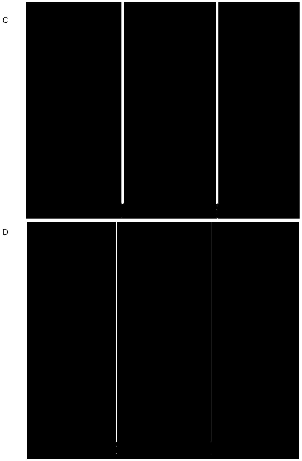 Application of 3-hydroxybutyric acid and derivatives thereof in preparation of anti-atherosclerosis products