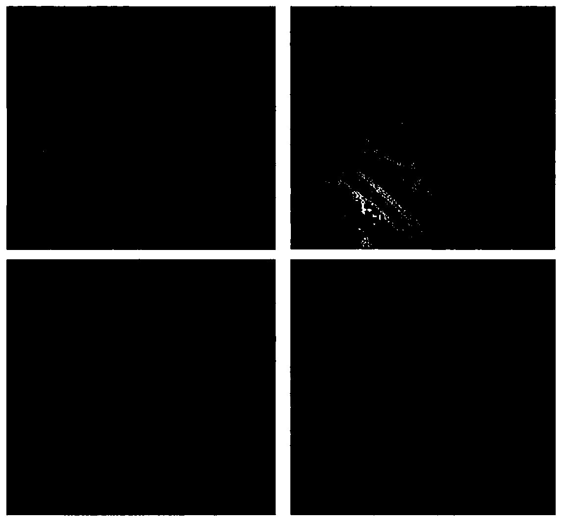 Application of 3-hydroxybutyric acid and derivatives thereof in preparation of anti-atherosclerosis products