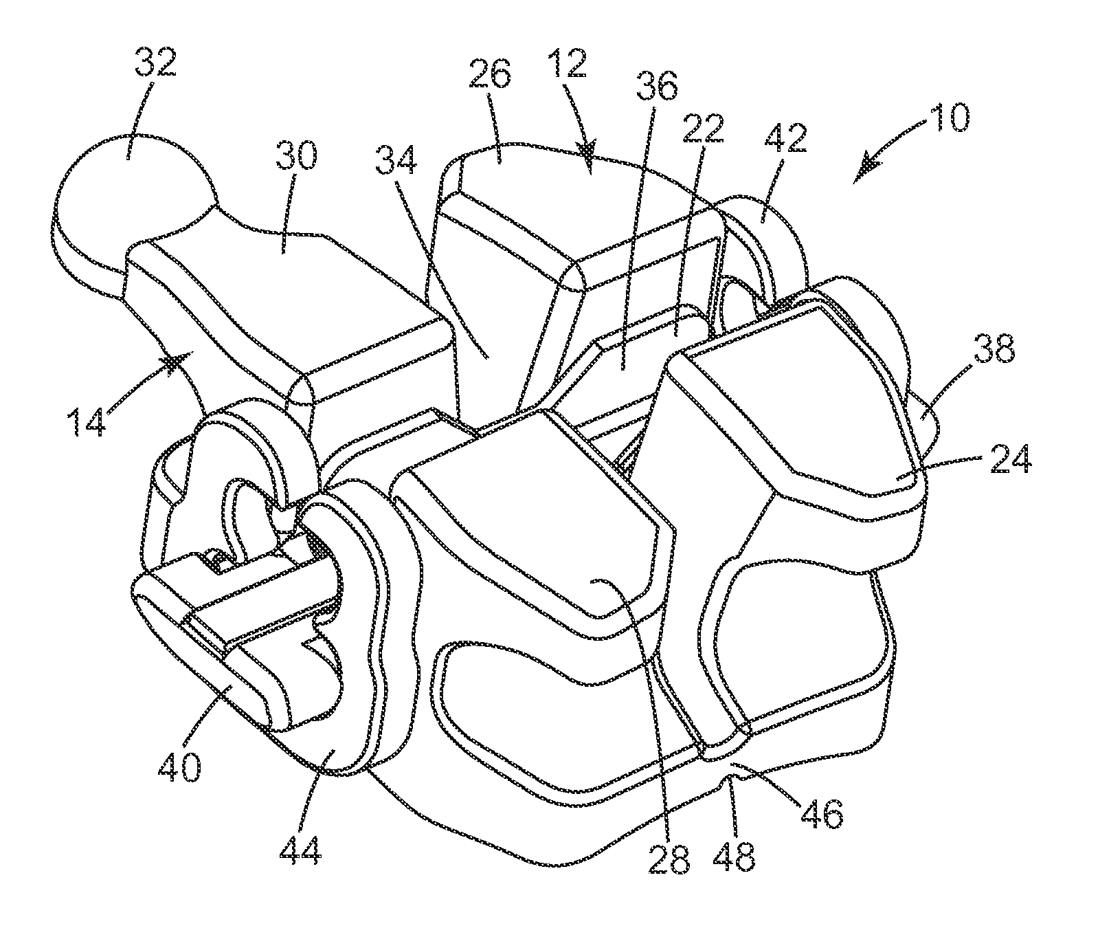 Ceramic orthodontic bracket with improved debonding characteristics