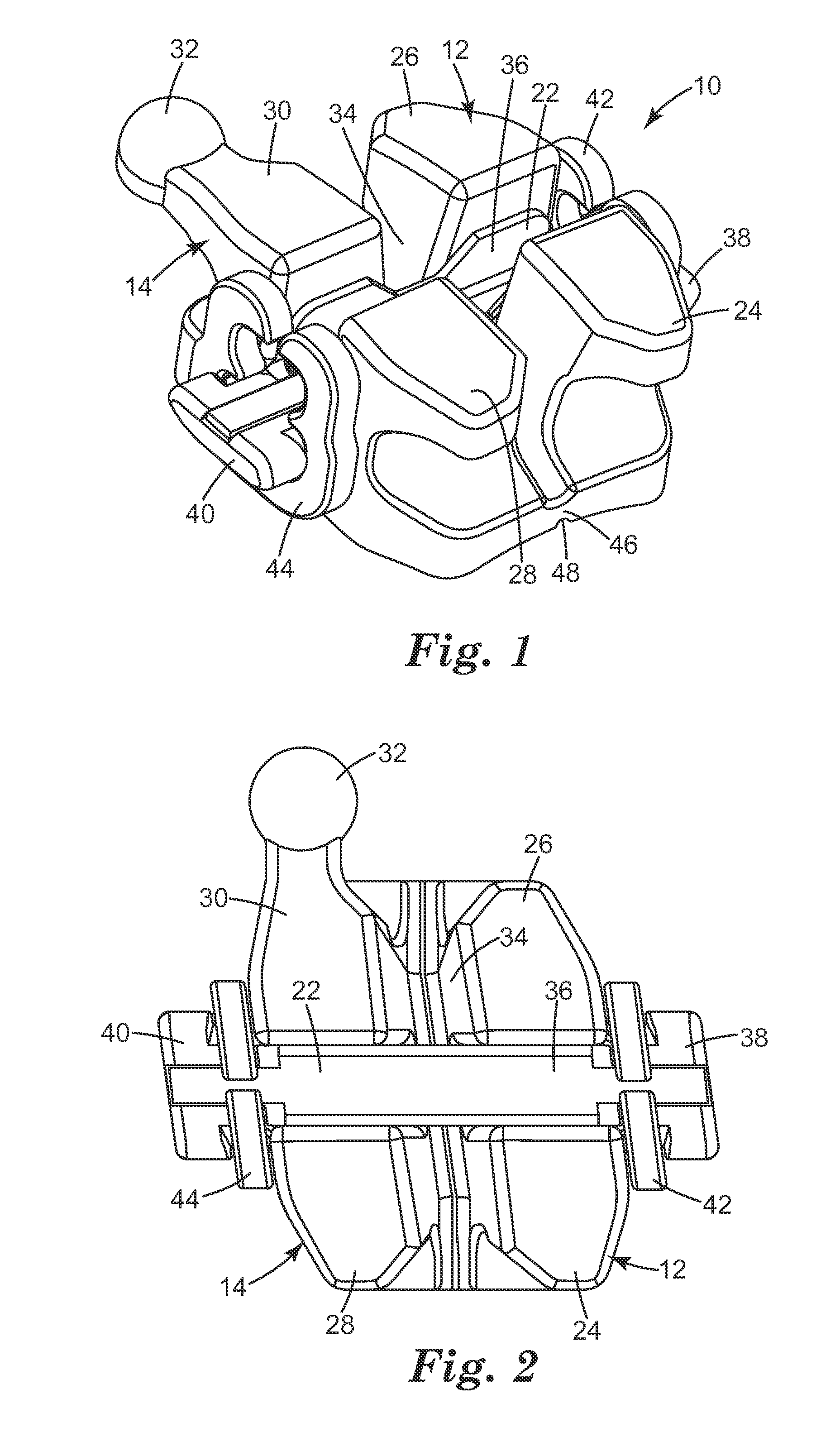 Ceramic orthodontic bracket with improved debonding characteristics