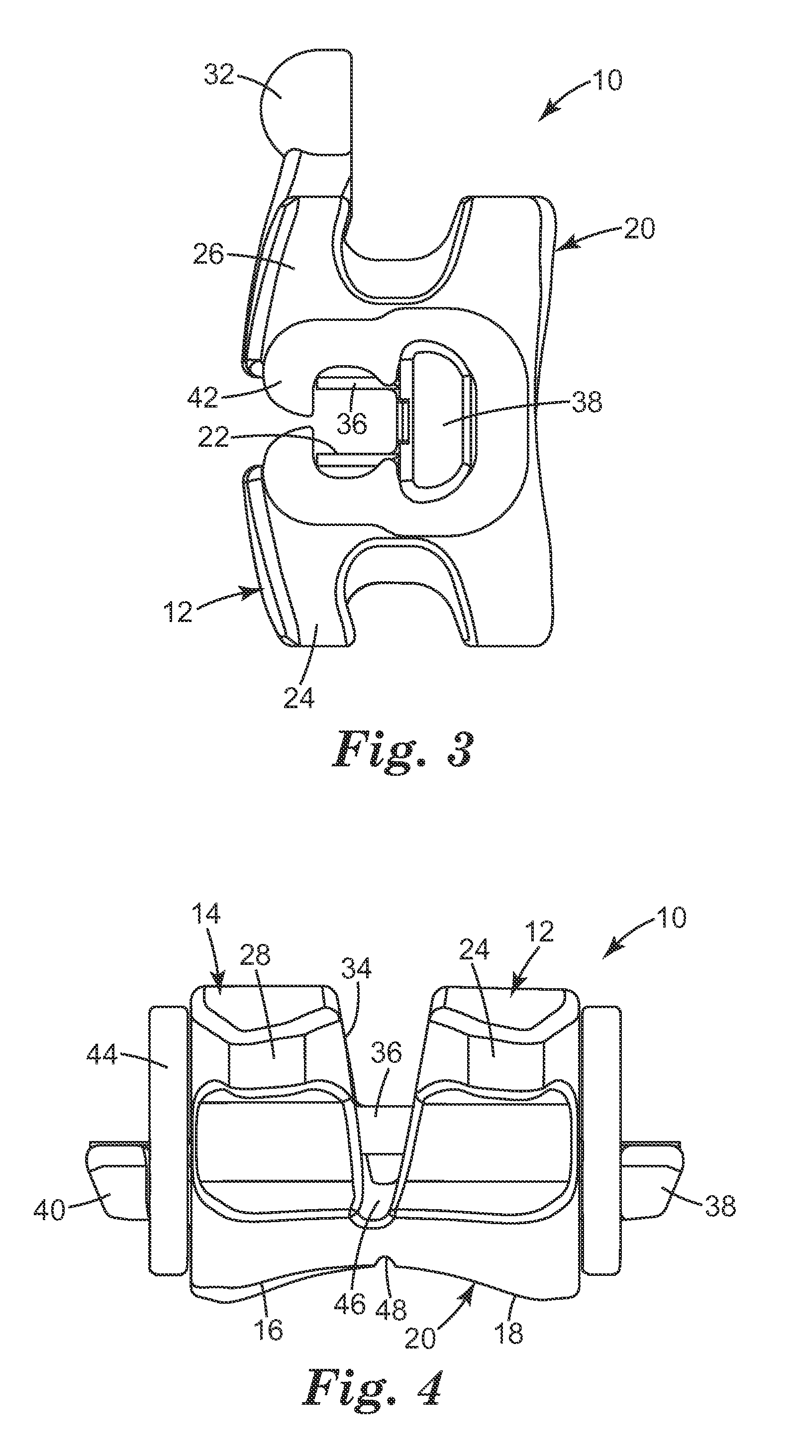 Ceramic orthodontic bracket with improved debonding characteristics