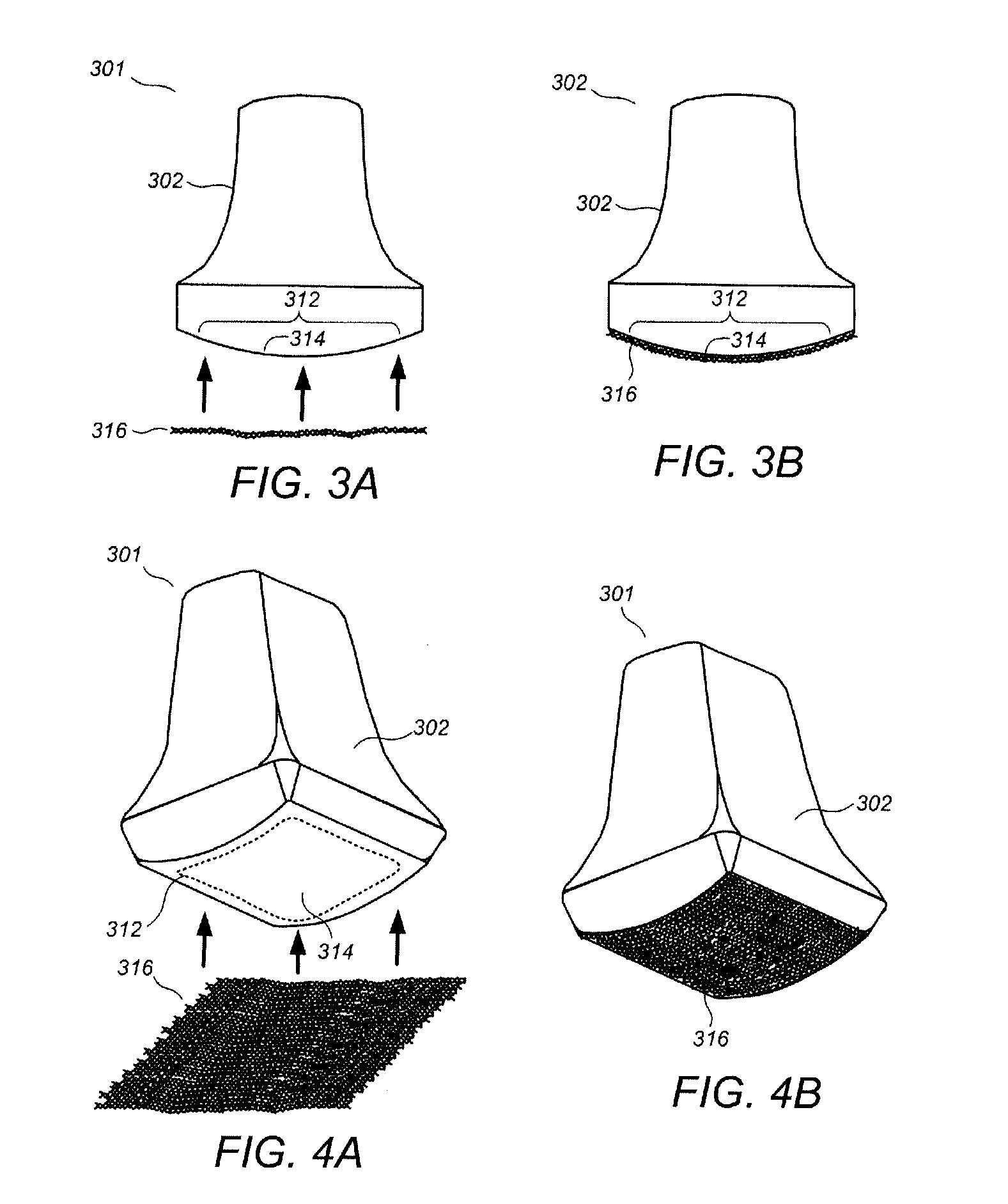 Handheld volumetric ultrasound scanning