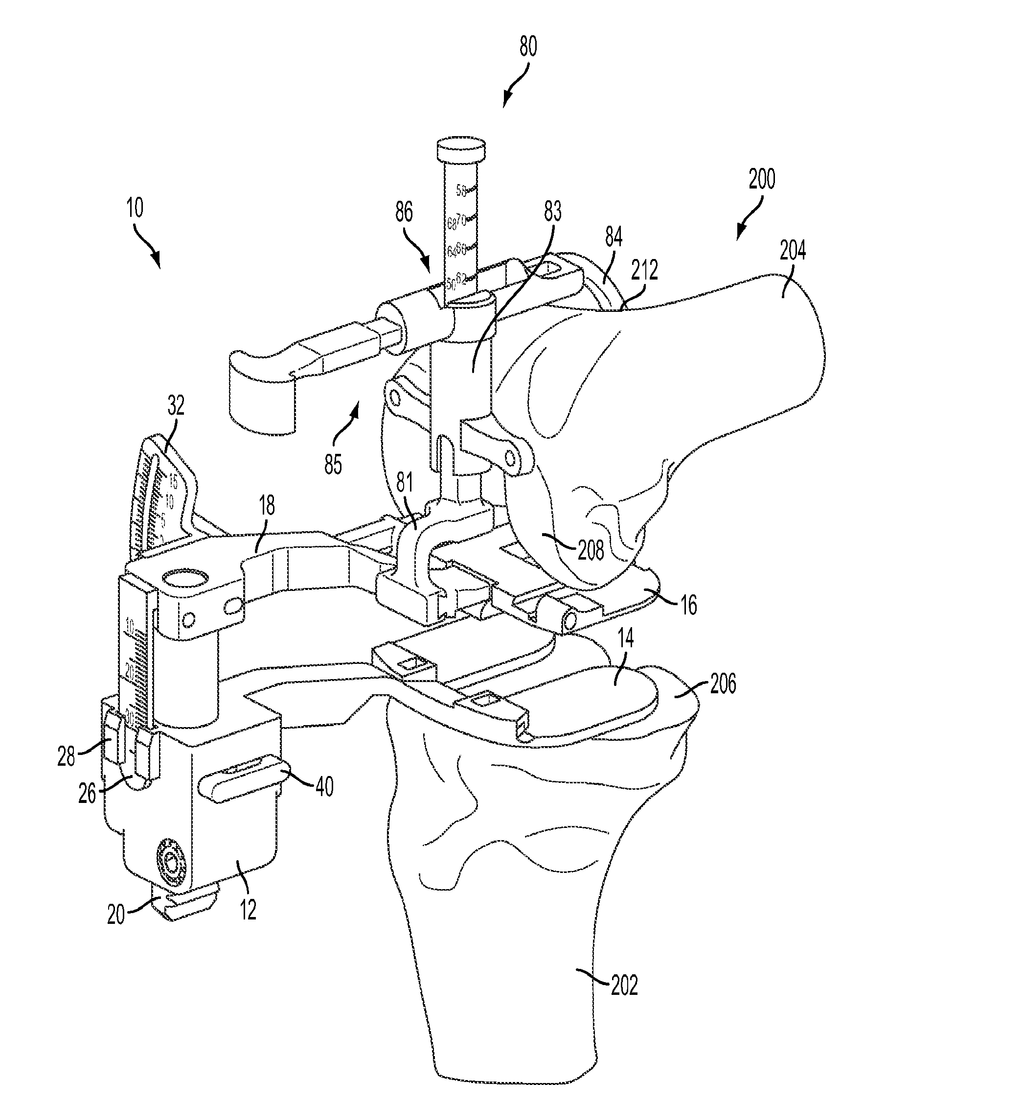 Knee arthroplasty instrument