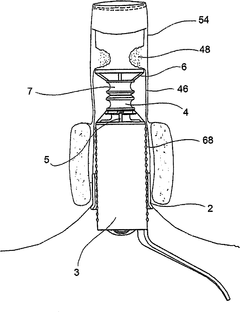 Rectal stump closure device for proctectomy