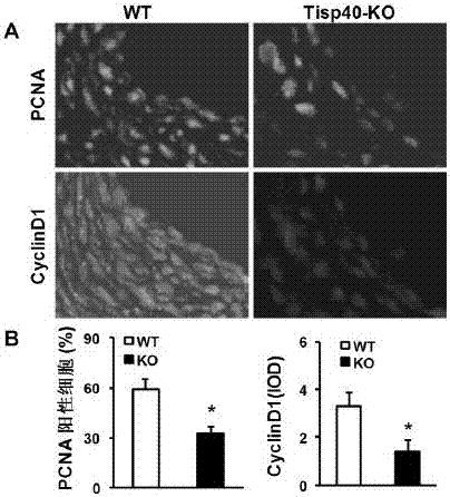 Function and application of transcription-induced spermatogenesis gene 40 (TISP40) in the treatment of restenosis after vascular injury