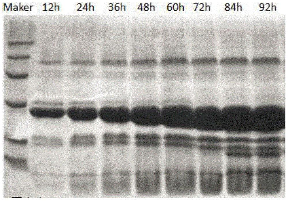 Method for efficiently expressing phospholipase