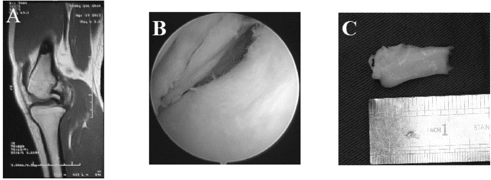 Mesenchymal stem cells from meniscus tissues as well as preparation method and identification thereof