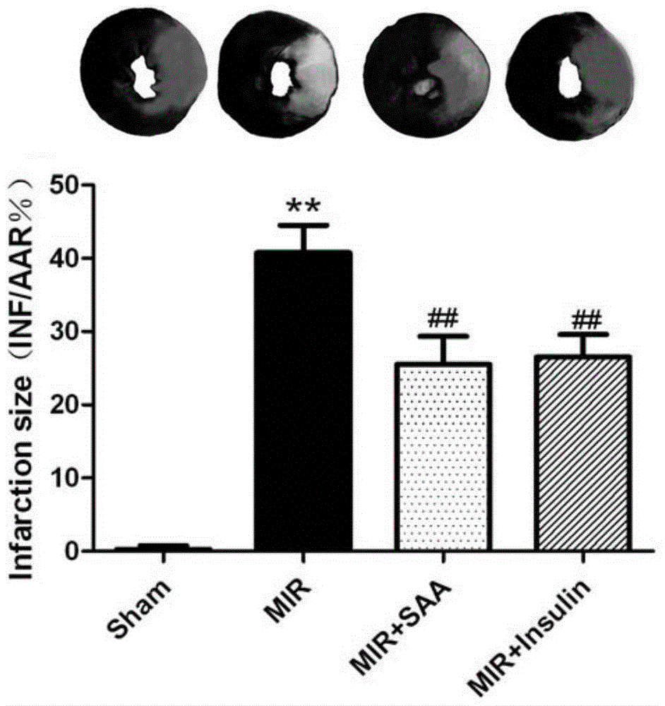 Application of amygdalin in protecting ischemic heart