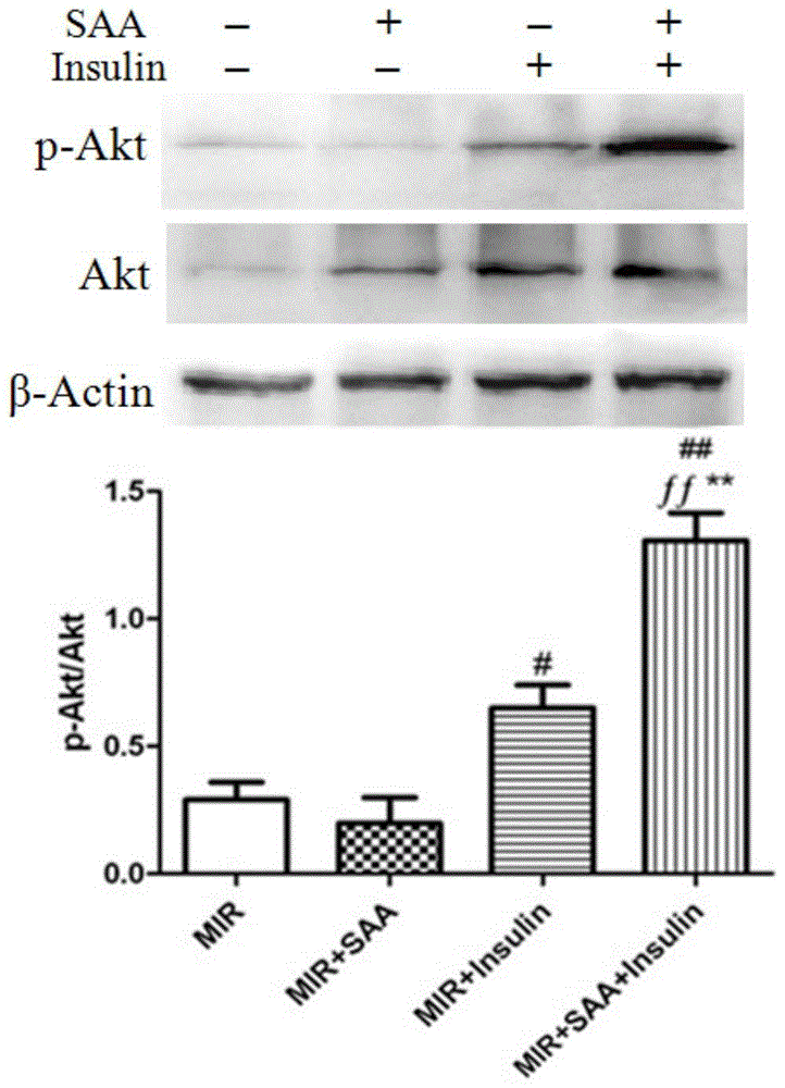 Application of amygdalin in protecting ischemic heart